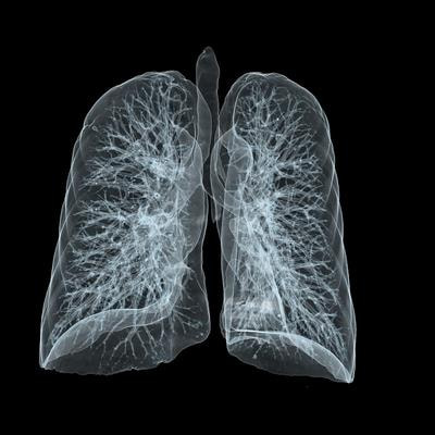 Cover image for research topic "Case Reports in Pulmonary Medicine"