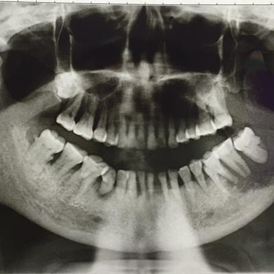Cover image for research topic "Oral Mucosa and Disorders: From Drug Discovery to Development and Translation"