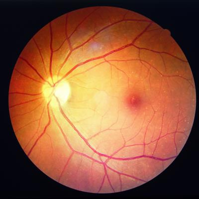 Cover image for research topic "In vivo retinal imaging in animal models"