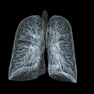 Cover image for research topic "A Multidisciplinary Approach to Treatment of Severe Chronic Airway Disease (CAD): Focus on Biomarkers"