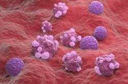 Cover image for research topic "Ovarian Cancer Targeted Medication: PARP Inhibitors, Anti-Angiogenic Drugs, Immunotherapy, and More"