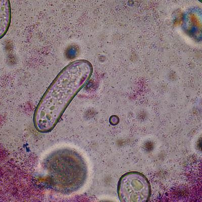 Cover image for research topic "The Molecular Regulation of Microbial Metabolism"