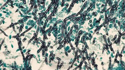 Cover image for research topic "Insights Into Fungal Biology With Emphasis on Pathogenesis in Humans"