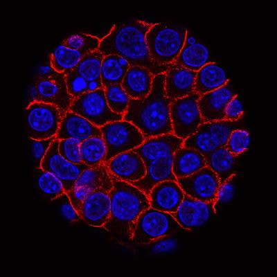 Cover image for research topic "Using Multi-Omics to Develop New Strategies to Improve Prognosis and Immunotherapy Outcomes in Cancers"