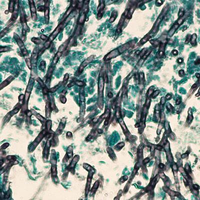 Cover image for research topic "New antifungals drugs in the pipeline and their potential benefits"