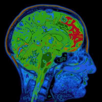Cover image for research topic "Rising Stars in Neuroradiology: 2022"
