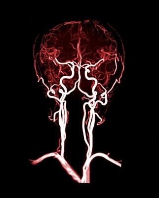 Cover image for research topic "Signaling Pathways and Therapeutic Targets in Stroke"