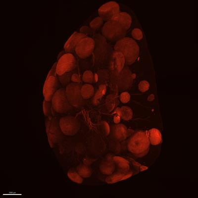 Cover image for research topic "Interplay Between Cancer and the Nervous System: Molecular and Cellular Mechanisms"