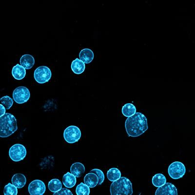 Cover image for research topic "Cardiotoxicity Monitoring and Prevention in Pediatric Acute Myeloid Leukemia"