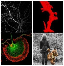 Cover image for research topic "The Fragile X Syndrome – Where Do We Go?"