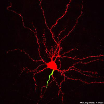 Cover image for research topic "Neurobiology of the Axon in Health and Disease"