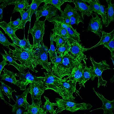 Cover image for research topic "Emerging Functions of Septins"