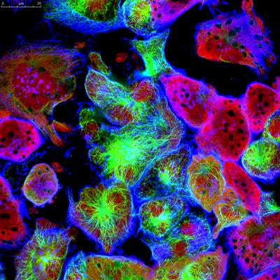 Cover image for research topic "New Insights into Ferroptosis of Cancer Cells: Molecular Mechanism and Clinical Perspectives of Ferroptosis in Cancer"