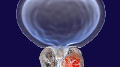 Cover image for research topic "Urological Diseases – Treatment Options Using Herbal Medicines"