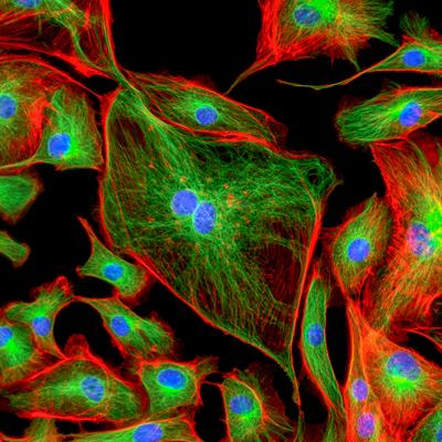 Cover image for research topic "Unconventional Roles of Endothelial Cells"