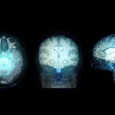 Cover image for research topic "Standardization, quantification and validation of imaging metrics of neurological diseases"