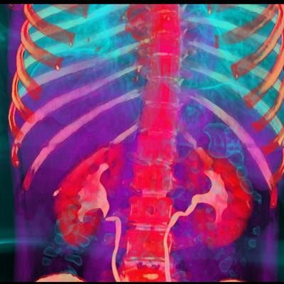 Cover image for research topic "Cardiorenal Disease: A practical approach"