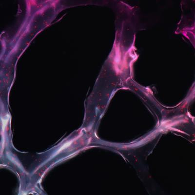 Cover image for research topic "Noncoding RNA in Disease: Diagnosis, Etiology, Progression, Prognosis and Treatment."