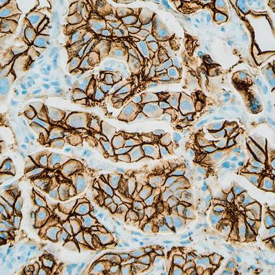 Cover image for research topic "Epigenetic and Metabolic Regulators of Breast Carcinogenesis"