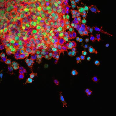 Cover image for research topic "Feature Extraction and Deep Learning for Digital Pathology Images"