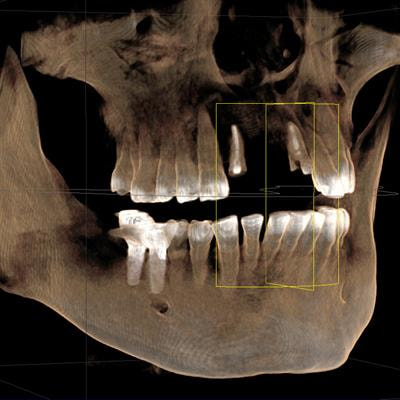Cover image for research topic "Advances in Bioactive Materials for Dental and Orthopedic Applications"