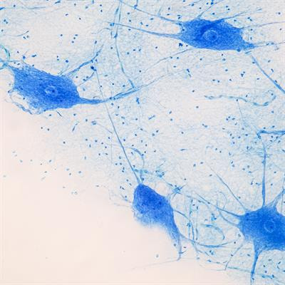 Cover image for research topic "Recent Advancements in Motor Imagery"