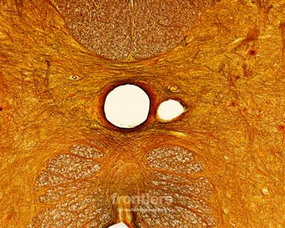 Cover image for research topic "The Role of CNS Ependymal Cells in Health and Disease"