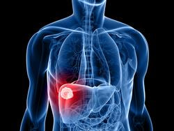 Cover image for research topic "The Role of Tumor Microenvironment in the Development, Treatment and Prognosis of Hepatocellular Carcinoma"