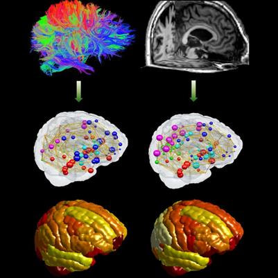Cover image for research topic "Network Spread Models of Neurodegenerative Diseases"