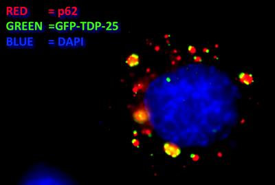 Cover image for research topic "The Role of the Protein Quality Control in Neurodegenerative Diseases"