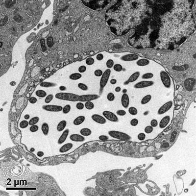 Cover image for research topic "Biology and Pathogenesis of Legionella"