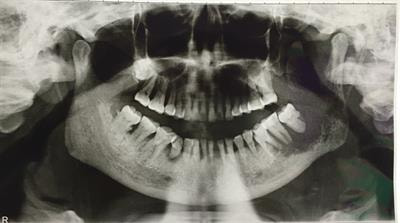 Cover image for research topic "Advances in Radiotherapy for Head and Neck Cancer"