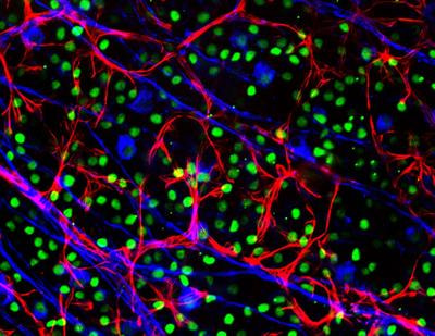 Cover image for research topic "Axonopathy in Neurodegenerative Disease"