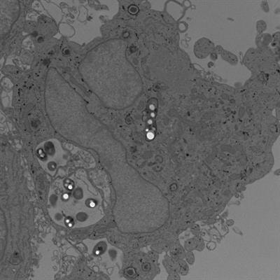 Cover image for research topic "Evasion of innate immunity by bacterial pathogens"