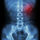 Cover image for research topic "Acute Kidney Injury: From Pathology to Phytotherapy"