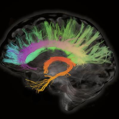 Cover image for research topic "Role of Neuroimaging in the Diagnosis and Treatment of Rare Diseases"
