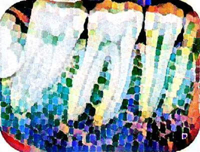 Cover image for research topic "Role of Oxidative Stress in Oral Diseases"