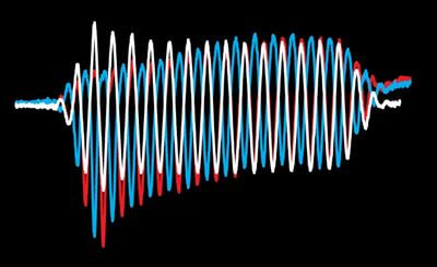 Cover image for research topic "New Advances in Electrocochleography for Clinical and Basic Investigation"