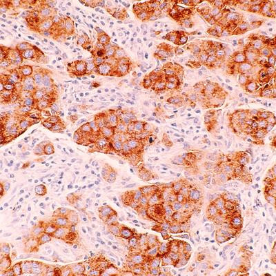 Cover image for research topic "Underlying Molecular Interconnections of the Estrogen Receptor alpha and Associated Factors involved in Breast Cancer Development: the Way to New Therapeutic Approaches - Volume II"