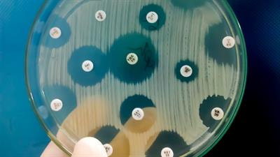 Cover image for research topic "Advances in Drug-induced Diseases, volume II"