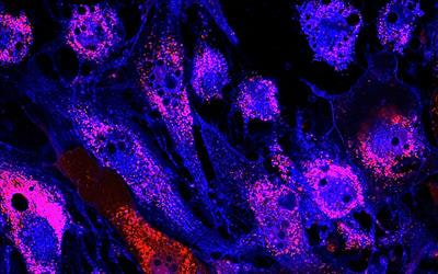 Cover image for research topic "Advances and Methods in Mesenchymal Stem Cells"