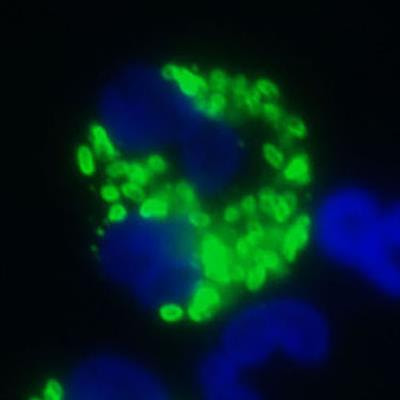 Cover image for research topic "Neutrophils and Microbial Pathogens: The Never Ending Battle"
