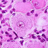 Cover image for research topic "Immune System Mechanisms Impacting the Onset of Epilepsy and Spontaneous Seizures"