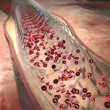Cover image for research topic "Reviews in Bioresorbable Scaffold"