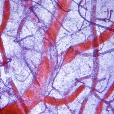 Cover image for research topic "Liquid Biopsy and New Omics Technologies in Vascular Malformations"