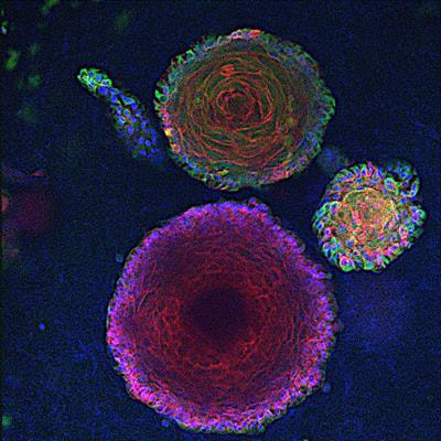 Cover image for research topic "Harnessing the Power of Patient Derived Models of Cancer"