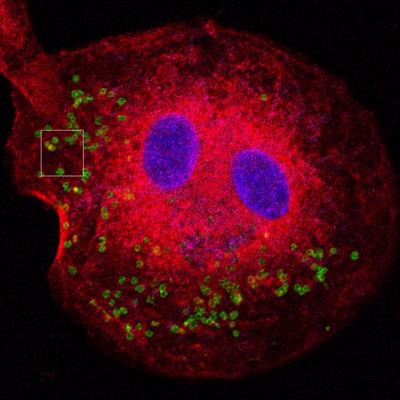 Cover image for research topic "Tularemia: Epidemiology, Ecology, Genomics, Immunity and Pathogenesis"