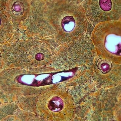 Cover image for research topic "Bone Cell Differentiation"