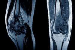 Cover image for research topic "Pharmacotherapeutics for Bone and Soft Tissue Tumours"