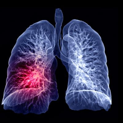 Cover image for research topic "Advances in Biomedical Image Segmentation and Analysis using Deep Learning"